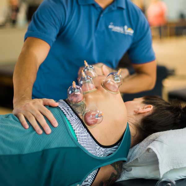 Cupping Therapy at Atlantic Physical Therapy Center