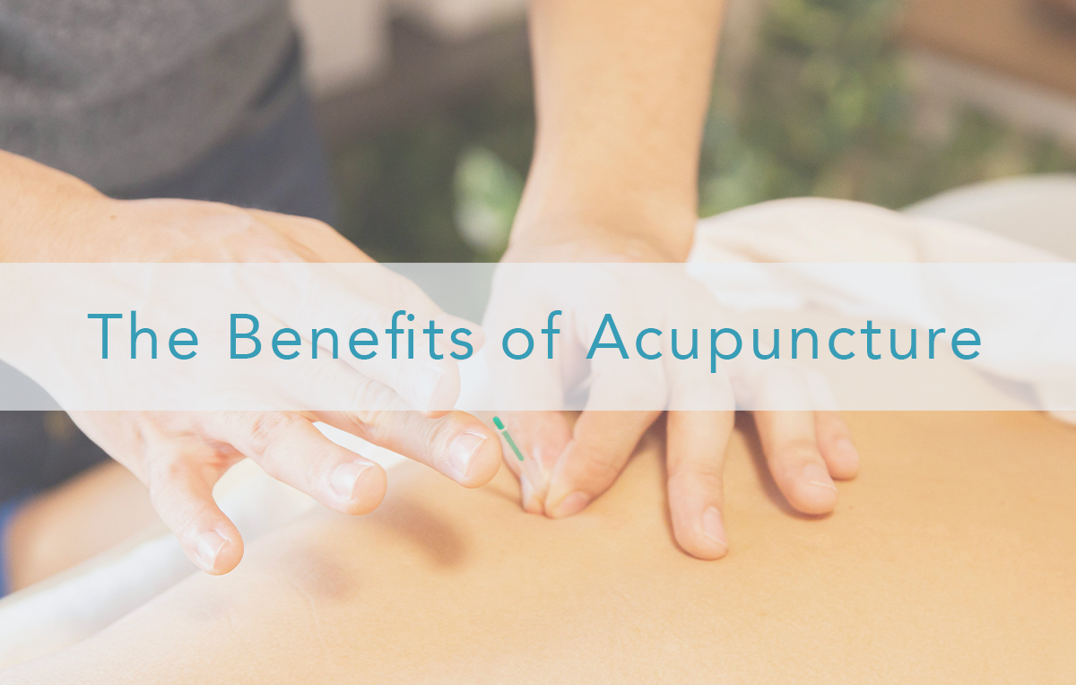 Benefits of Acupuncture | Atlantic Physical Therapy Center